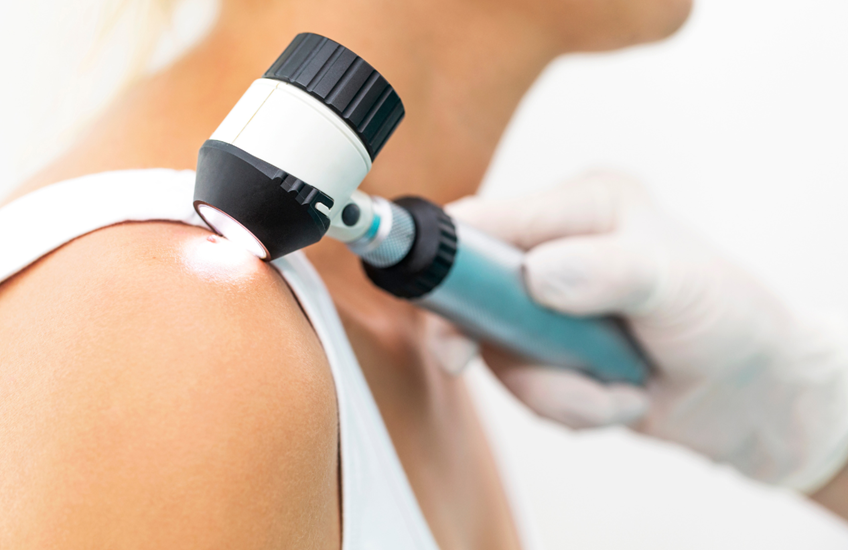 Dermatologist uses medical device to look at mole on woman's shoulder