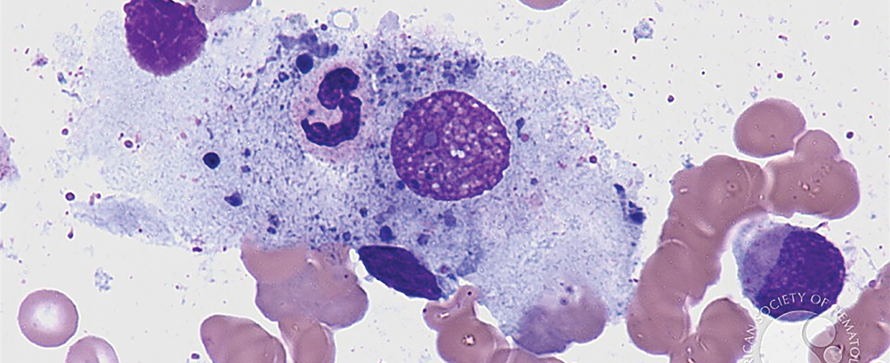 Image of Phagocytic Macrophage