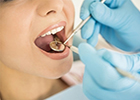 Thumbnail: General Dentistry