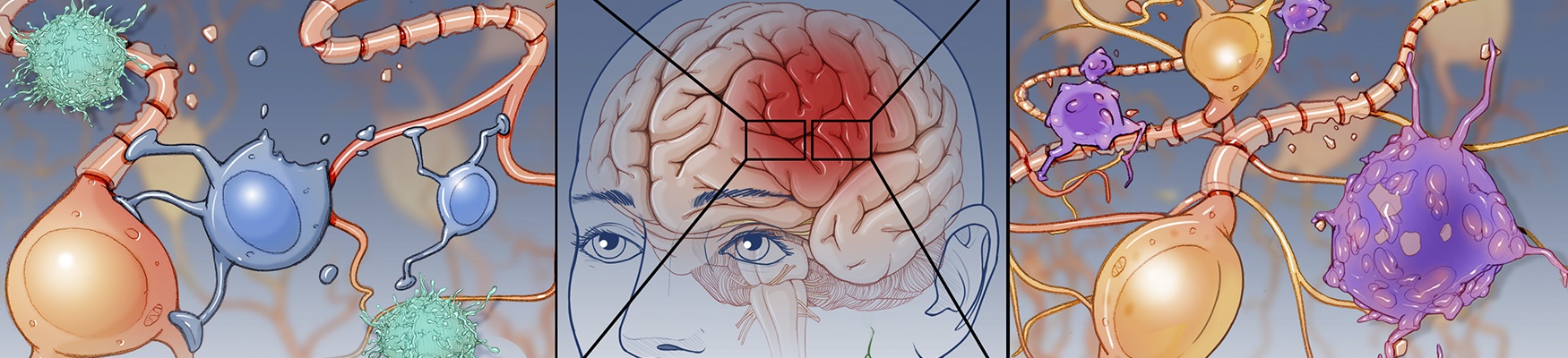 neurosurgery research promo image