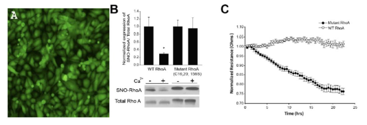 Adenovirus-mediated gene expression in human lung microvascular endothelial cells.